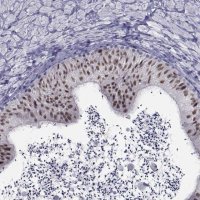 Anti-PAX2 antibody produced in rabbit 