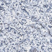 Anti-PBRM1 antibody produced in rabbit 