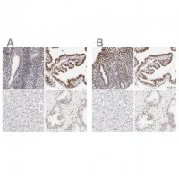 Anti-PBX1 antibody produced in rabbit 