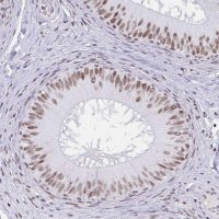 Anti-PBX2 antibody produced in rabbit HPA061478-100UL