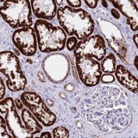 Anti-PCCA antibody produced in rabbit HPA047792-100UL