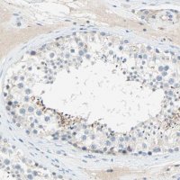 Anti-PCDHB2 antibody produced in rabbit 