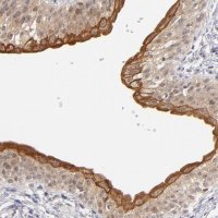 Anti-PCNX4 antibody produced in rabbit HPA002076-100UL