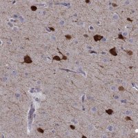 Anti-PCP4L1 antibody produced in rabbit 
