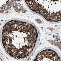 Anti-PDCD5 antibody produced in rabbit 