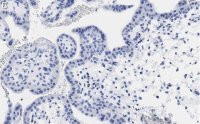 Anti-PDE4B Antibody, clone 1E9 ZooMAb Rabbit Monoclonal 