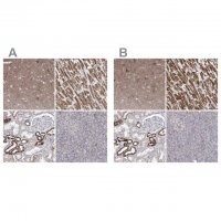 Anti-PDHB antibody produced in rabbit 