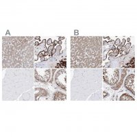 Anti-PDIA5 antibody produced in rabbit 