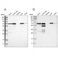 Anti-PDLIM5 antibody produced in rabbit 