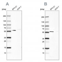 Anti-PDP1 antibody produced in rabbit HPA019081-100UL