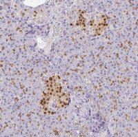 Anti-PDX1 antibody produced in rabbit 