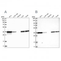 Anti-PDXK antibody produced in rabbit 