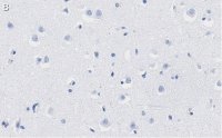 Anti-PEA15 Antibody, clone 2J13 ZooMAb Rabbit Monoclonal 