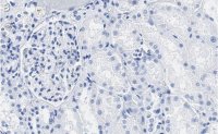 Anti-PEDF (SERPIN F1) Antibody, clone 2C16 ZooMAb Rabbit Monoclonal 