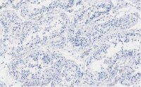 Anti-PER2 Antibody, clone 1G17 ZooMAb Rabbit Monoclonal 
