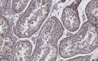 Anti-Pericentrin Antibody, clone 2H11, ZooMAb Rabbit Monoclonal 
