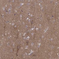 Anti-PEX5L antibody produced in rabbit 