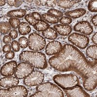 Anti-PFDN2 antibody produced in rabbit 