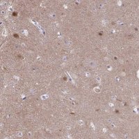 Anti-PGM2L1 antibody produced in rabbit HPA056995-100UL