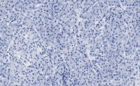 Anti-PGP9.5/UCHL1 Antibody, clone 3C13 ZooMAb Rabbit Monoclonal 