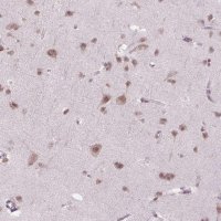Anti-PHAX antibody produced in rabbit 
