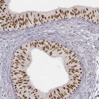 Anti-PHF6 antibody produced in rabbit 