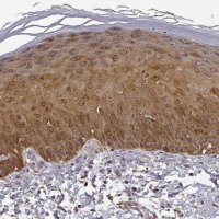 Anti-PHGDH antibody produced in rabbit 