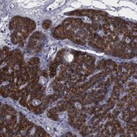Anti-PHKA1 antibody produced in rabbit 