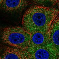 Anti-PHKG2 antibody produced in rabbit 