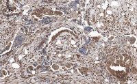 Anti-phospho JNK (Thr183, Tyr185) Antibody, clone 3F7, ZooMAb Rabbit Monoclonal 