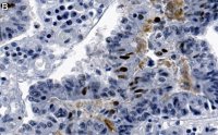 Anti-phospho-Chk2-Thr68 Antibody, clone 1B17 ZooMAb Rabbit Monoclonal 