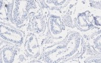 Anti-phospho-Histone H2A.X (Ser139) Antibody, clone 6L16, ZooMAb Rabbit Monoclonal 