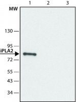 Anti-Phospholipase A2 (iPLA2) (C-terminal region) antibody produced in rabbit 