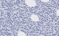 Anti-phosphotyrosine Antibody, clone 4G10 ZooMAb Mouse Monoclonal 