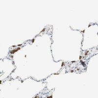 Anti-PI15 antibody produced in rabbit HPA006593-100UL