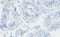 Anti-PIAS Antibody, clone 1O17 ZooMAb Rabbit Monoclonal 