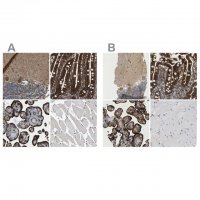 Anti-PICALM antibody produced in rabbit 