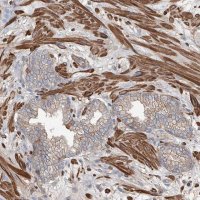 Anti-PIEZO2 antibody produced in rabbit 