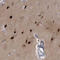 Anti-PINX1 antibody produced in rabbit HPA023139-100UL