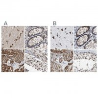 Anti-PITRM1 antibody produced in rabbit HPA006753-100UL