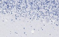 Anti-PKC Antibody, clone 1C13 ZooMAb Rabbit Monoclonal 