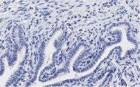 Anti-PKC Antibody, clone 1J13 ZooMAb Rabbit Monoclonal 