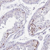 Anti-PKDREJ antibody produced in rabbit 