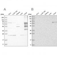Anti-PKP1 antibody produced in rabbit 