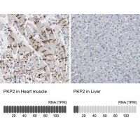 Anti-PKP2 antibody produced in rabbit 