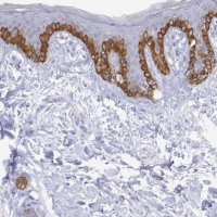 Anti-PLA2G4E antibody produced in rabbit 