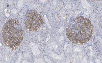 Anti-PLA2R1 Antibody, clone 1D5, ZooMAb Rabbit Monoclonal 