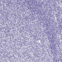 Anti-PLAC1 antibody produced in rabbit 