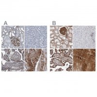Anti-PLEC antibody produced in rabbit 