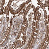 Anti-PLEKHA7 antibody produced in rabbit 